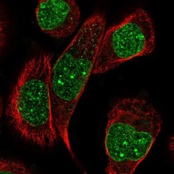 DNMT3B Antibody, Novus Biologicals:Antibodies:Primary Antibodies