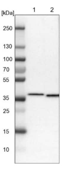 SCAMP2 Antibody, Novus Biologicals 25 &mu;L; Unlabeled:Antibodies, Polyclonal