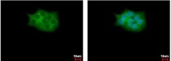 SCAP2 Antibody, Novus Biologicals 0.1mg; Unlabeled:Antibodies, Polyclonal
