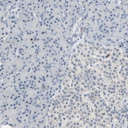 SCAP2 Antibody, Novus Biologicals 0.1mL; Unlabeled:Antibodies, Polyclonal