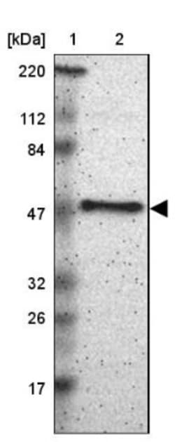 SCAP2 Antibody, Novus Biologicals 0.1mL; Unlabeled:Antibodies, Polyclonal