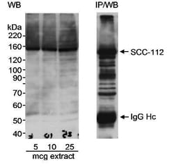 SCC112 Antibody, Novus Biologicals 0.1mL; Unlabeled:Antibodies, Polyclonal