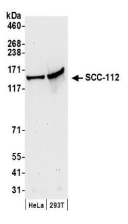 SCC112 Antibody, Novus Biologicals 0.1mL; Unlabeled:Antibodies, Polyclonal
