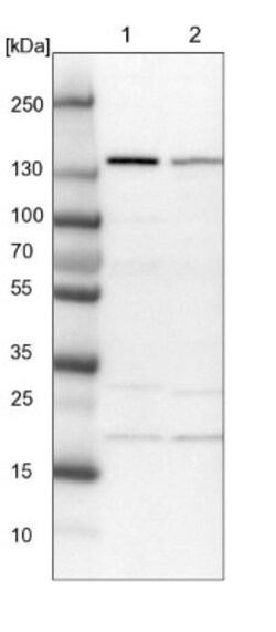 SCC112 Antibody, Novus Biologicals:Antibodies:Primary Antibodies