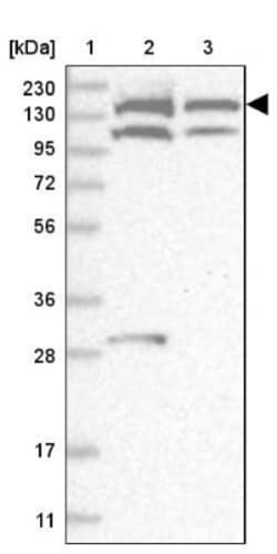 SCC112 Antibody, Novus Biologicals 0.1mL; Unlabeled:Antibodies, Polyclonal