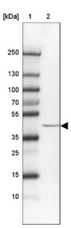 SCCPDH Antibody, Novus Biologicals 0.1mL; Unlabeled:Antibodies, Polyclonal