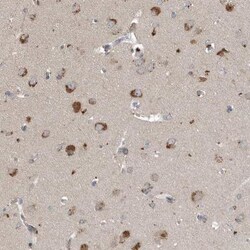 SCFD2 Antibody, Novus Biologicals:Antibodies:Primary Antibodies