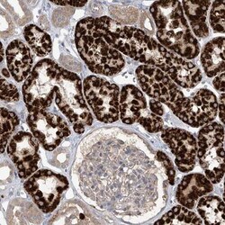 SCGB1D2 Antibody, Novus Biologicals 0.1mL; Unlabeled:Antibodies, Polyclonal