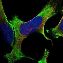 SCIN Antibody, Novus Biologicals:Antibodies:Primary Antibodies