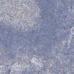 SCIN Antibody, Novus Biologicals:Antibodies:Primary Antibodies