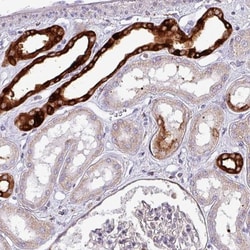 SCIN Antibody, Novus Biologicals:Antibodies:Primary Antibodies