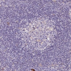 SCIN Antibody, Novus Biologicals:Antibodies:Primary Antibodies