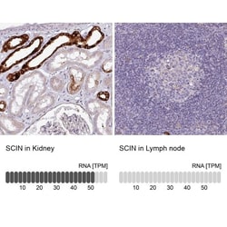 SCIN Antibody, Novus Biologicals:Antibodies:Primary Antibodies