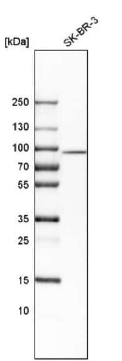 SCIN Antibody, Novus Biologicals:Antibodies:Primary Antibodies