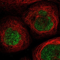 SCML1 Antibody, Novus Biologicals:Antibodies:Primary Antibodies