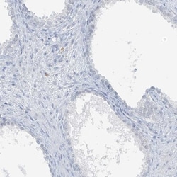 SCML1 Antibody, Novus Biologicals 0.1mL; Unlabeled:Antibodies, Polyclonal