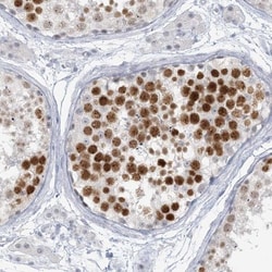 SCML1 Antibody, Novus Biologicals 0.1mL; Unlabeled:Antibodies, Polyclonal