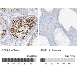 SCML1 Antibody, Novus Biologicals 0.1mL; Unlabeled:Antibodies, Polyclonal