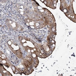 SCN11A Antibody, Novus Biologicals 25 &mu;L; Unlabeled:Antibodies, Polyclonal