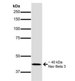 SCN3B Antibody (S396-29), Novus Biologicals:Antibodies:Primary Antibodies