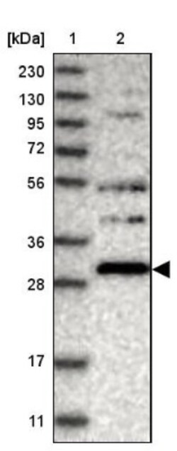 SCO1 Antibody, Novus Biologicals 25 &mu;L; Unlabeled:Antibodies, Polyclonal