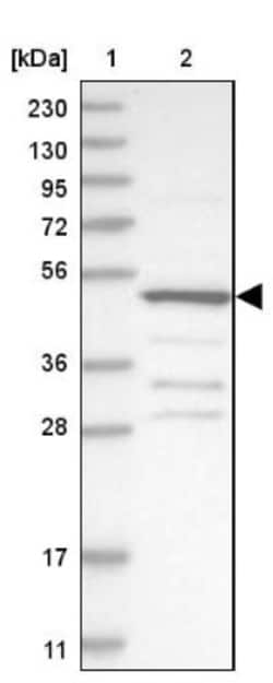 Sterol carrier protein 2 Antibody, Novus Biologicals 25 &mu;L; Unlabeled:Antibodies,