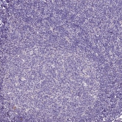 SCRT1 Antibody, Novus Biologicals 25 &mu;L, Unconjugated:Antibodies, Polyclonal