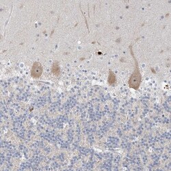 SDAD1 Antibody, Novus Biologicals:Antibodies:Primary Antibodies