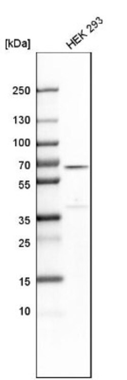 SDCCAG10 Antibody, Novus Biologicals 0.1mL; Unlabeled:Antibodies, Polyclonal