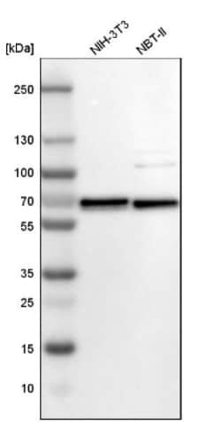 SDCCAG10 Antibody, Novus Biologicals 0.1mL; Unlabeled:Antibodies, Polyclonal
