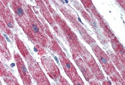 SDHB Antibody, Novus Biologicals 0.1mg; Unlabeled:Antibodies, Polyclonal