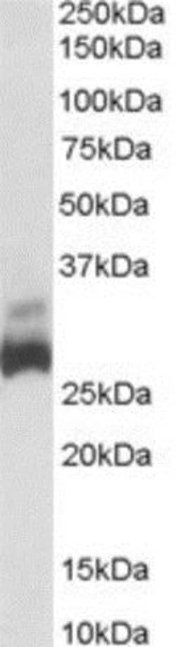 SDHB Antibody, Novus Biologicals 0.1mg; Unlabeled:Antibodies, Polyclonal