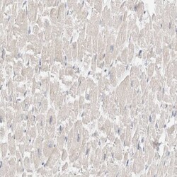 SDR16C5 Antibody, Novus Biologicals 0.1mL; Unlabeled:Antibodies, Polyclonal