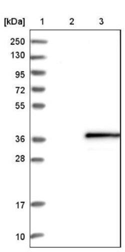 SDR16C5 Antibody, Novus Biologicals 0.1mL; Unlabeled:Antibodies, Polyclonal