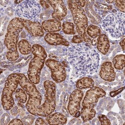 SDR39U1 Antibody, Novus Biologicals 25 &mu;L | Buy Online | Novus Biologicals | Fisher Scientific