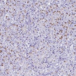 SDR42E2 Antibody, Novus Biologicals 0.1mL; Unlabeled:Antibodies, Polyclonal