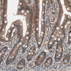 SDSL Antibody, Novus Biologicals 0.1mL; Unlabeled:Antibodies, Polyclonal