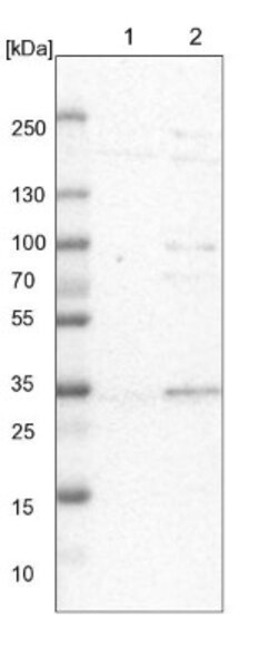 SDSL Antibody, Novus Biologicals 0.1mL; Unlabeled:Antibodies, Polyclonal