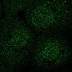 SEC14L2 Antibody, Novus Biologicals:Antibodies:Primary Antibodies