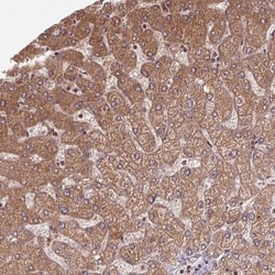 SEC14L2 Antibody, Novus Biologicals:Antibodies:Primary Antibodies