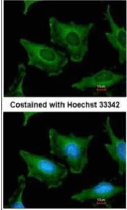 SEC23A Antibody, Novus Biologicals 0.1mg; Unlabeled:Antibodies