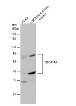 SEC61A Antibody, Novus Biologicals 0.1mg; Unlabeled:Antibodies, Polyclonal