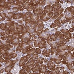 SEC63 Antibody, Novus Biologicals:Antibodies:Primary Antibodies