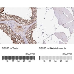 SEC63 Antibody, Novus Biologicals:Antibodies:Primary Antibodies