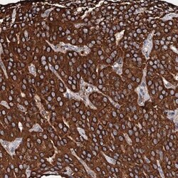 SECISBP2L Antibody, Novus Biologicals 0.1mL; Unlabeled:Antibodies, Polyclonal