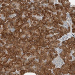 SEL1L Antibody, Novus Biologicals 0.1mL; Unlabeled:Antibodies, Polyclonal
