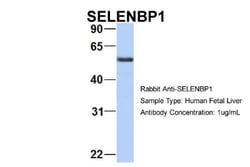 SELENBP1 Antibody, Novus Biologicals 0.05mg; Unlabeled:Antibodies, Polyclonal
