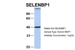 SELENBP1 Antibody, Novus Biologicals 0.05mg; Unlabeled:Antibodies, Polyclonal