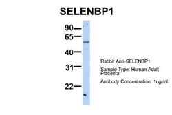 SELENBP1 Antibody, Novus Biologicals 0.05mg; Unlabeled:Antibodies, Polyclonal