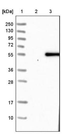 SELENBP1 Antibody, Novus Biologicals 0.1mL; Unlabeled:Antibodies, Polyclonal